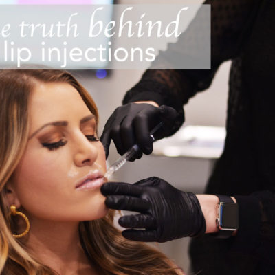The Truth Behind Lip Injections